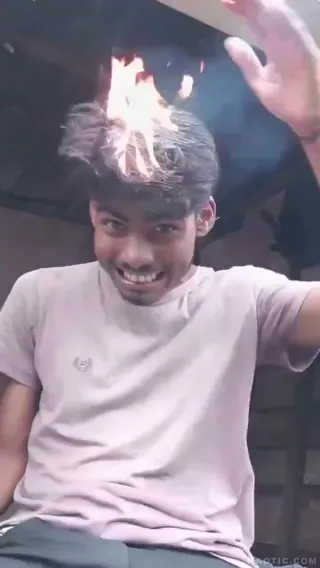 Amikor túl sok a hajad